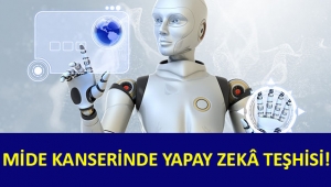 Mide kanserinin teşhisinde yapay zekâ...