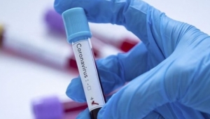 Çin’den alınan ilk parti hızlı tanı kitleri Türkiye’ye getirildi! İşte detaylar...