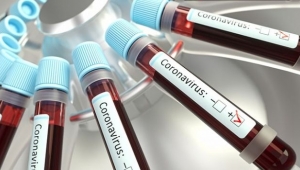 İngiltere'de Covid-19 salgını 13 yaşındaki bir çocuğun ölümüne neden oldu! İşte detaylar...