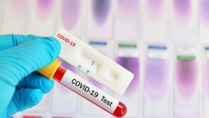 Ücretsiz PCR testi uygulaması! İşte detaylar...