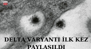 Delta Varyantının İlk Kez Fotoğrafı Paylaşıldı! İşte detaylar...