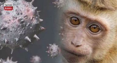 Maymun Çiçeği Vaka Sayısı Bir Haftada 3 Kat Arttı! İşte detaylar...