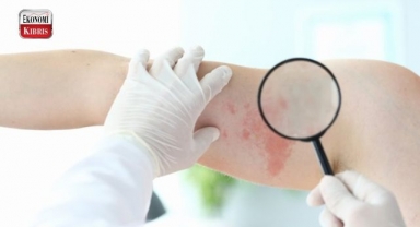 Koronavirüs ve maymun çiçeği derken şimdi de domates gribi çıktı! İşte detaylar...